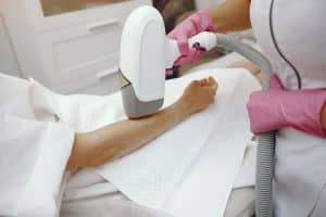 Epilation à la lumière pulsée à Paris